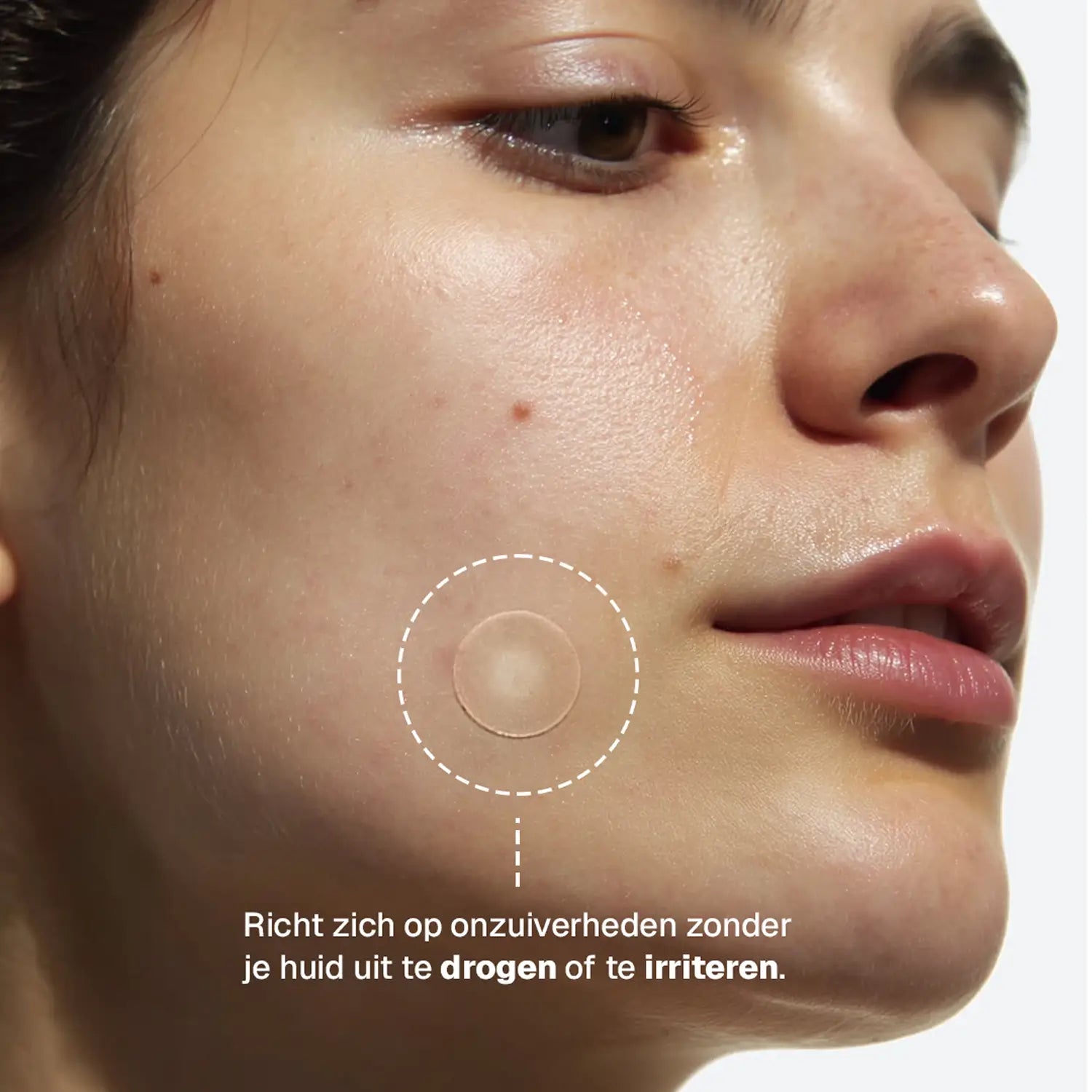 Clear Dots - Patchs Anti-Acné