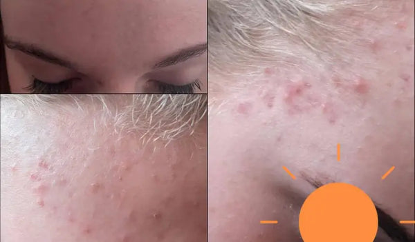 Sa peau est devenue plus calme, et elle aussi.