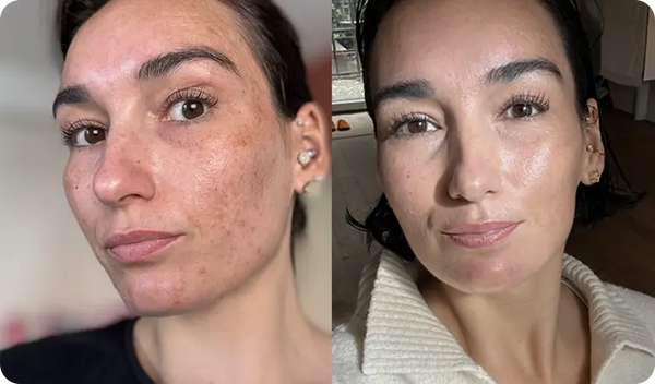 Ma peau est plus calme et plus uniforme