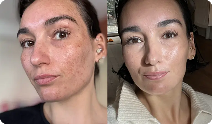 Esza (30 ans)