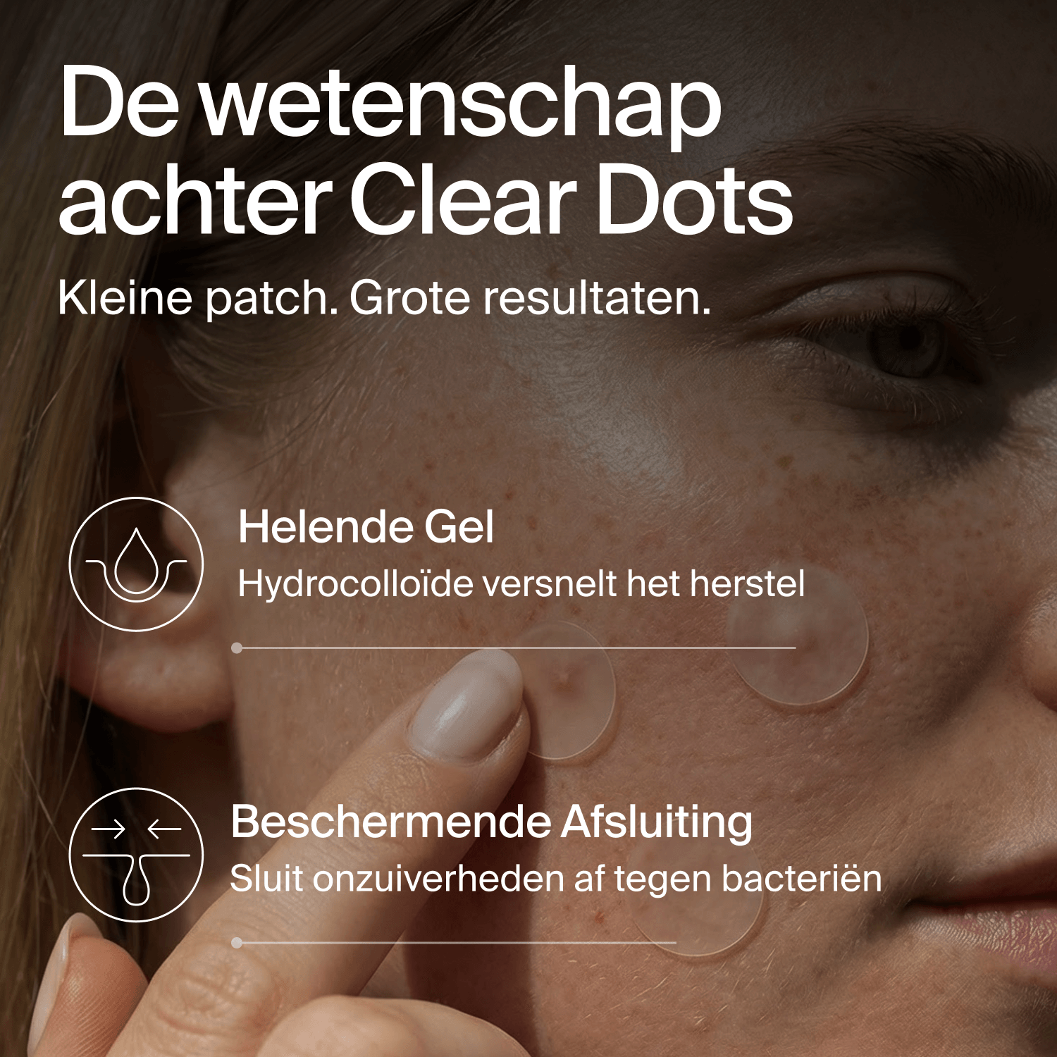 Clear Dots - Patchs Anti-Acné