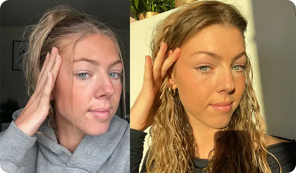 Je pensais que ça faisait partie de ma peau